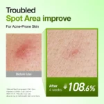 ⁦سيروم أنوا أزيليك أسيد 10% + هيالورون لتهدئة الاحمرار وترطيب البشرة – 30 مل⁩ - الصورة ⁦4⁩