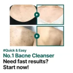 Some By Mi AHA, BHA, PHA 30 Days Miracle Clear Body Cleanser – 400 ml - Image 3
