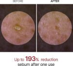 ⁦أمبول تقشير البشرة بالأرز الأسود والنياسيناميد للإشراقة والترطيب من Dr.Melaxin – 80 ml⁩ - الصورة ⁦3⁩