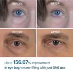 ⁦كريم دكتور ميلاكسين آي فالت للهالات والانتفاخ تحت العين – 10 مل⁩ - الصورة ⁦6⁩