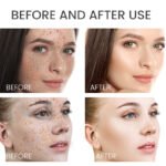 ⁦سيروم الورد والنياسيناميد لإخفاء البقع 30 مل – ESTELIN Rosehip Niacinamide Spots Fading Face Serum⁩ - الصورة ⁦6⁩